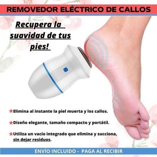 SOFT FEET™ Removedor de asperezas y callos para pies (Eléctrico)
