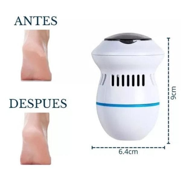 SOFT FEET™ Removedor de asperezas y callos para pies (Eléctrico)